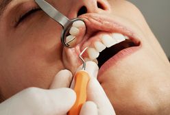 Czym jest bonding zębów i kiedy można go wykonać?