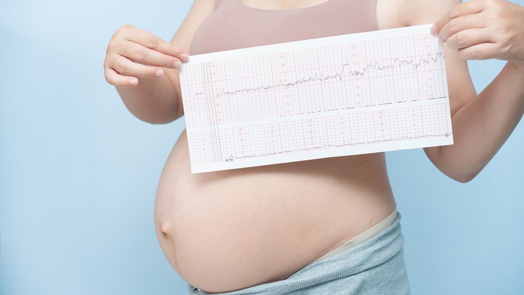 Jedną z metod monitorowania akcji serca dziecka jest kardiotokografia