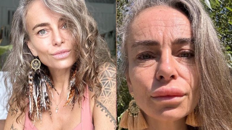 Kasia Nast wstrzyknęła sobie jad żaby