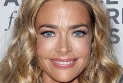 ''Dzikie żądze'': Denise Richards przesadziła z ostrzykiwaniem twarzy?