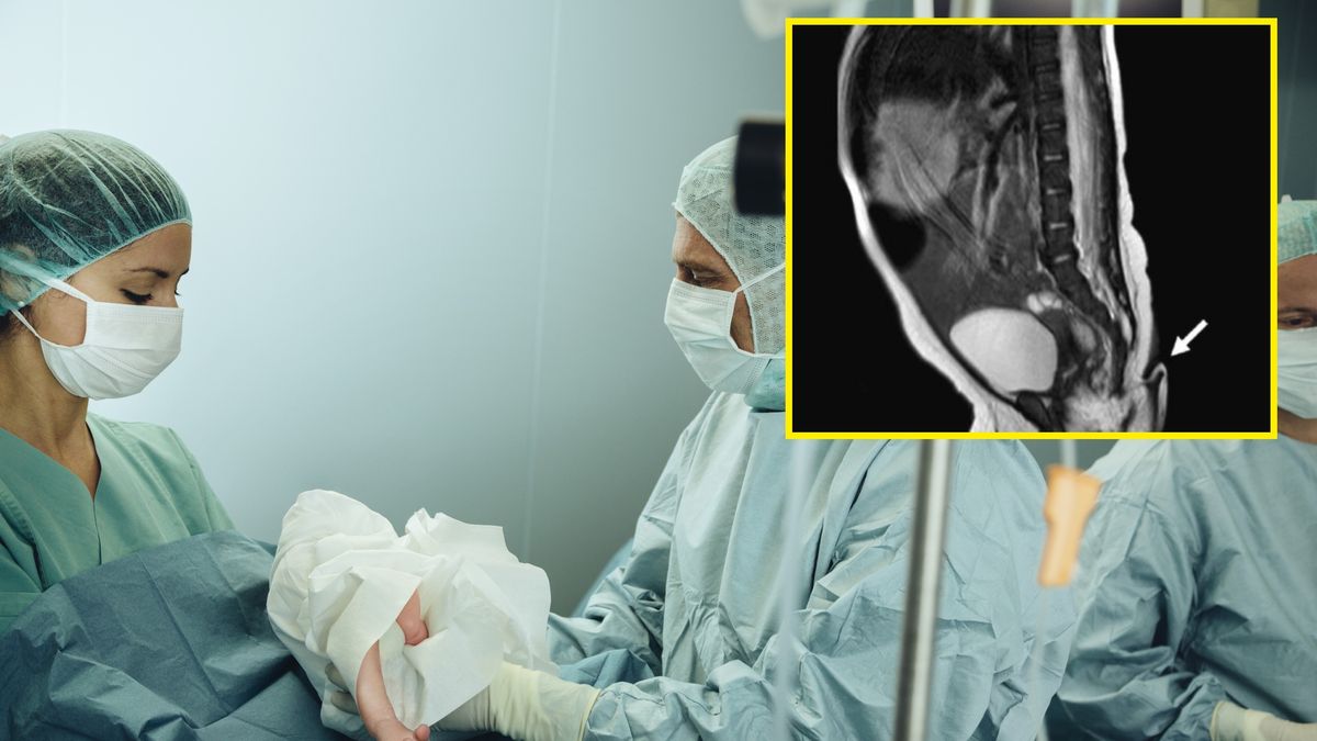 Dziecko urodziło z kilkucentymetrowym ogonem. Zdj. ilustracyjne 