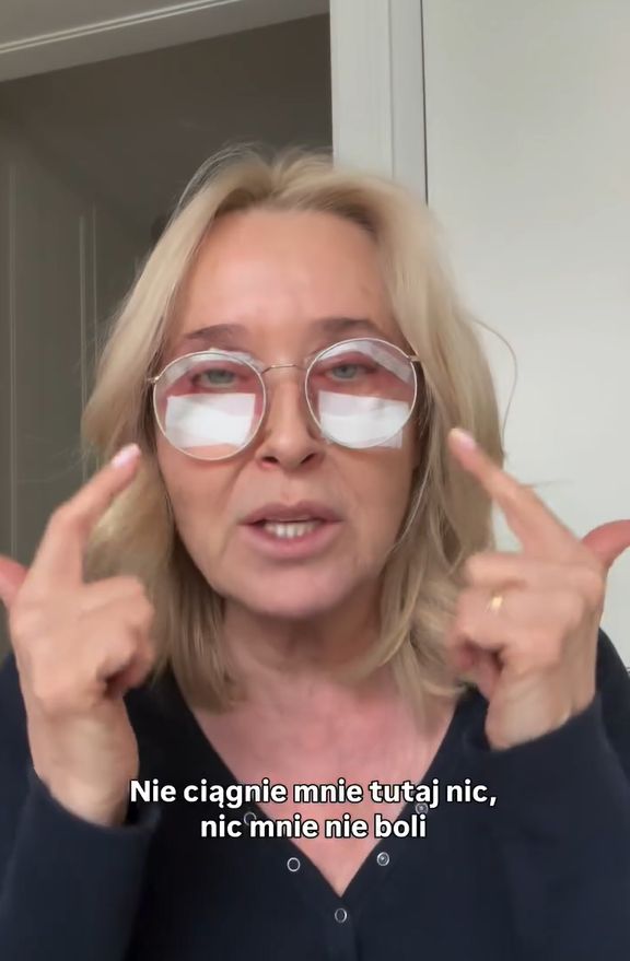 Agata Młynarska zrobiła operację powiek