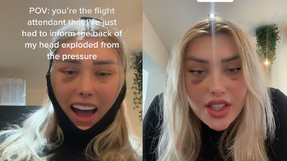 Kobieta o swoich przeżyciach opowiedziała w social mediach