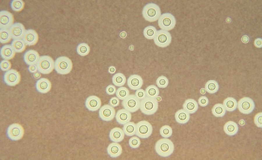 Mikroskopowy obraz grzyba Cryptococcus neoformans