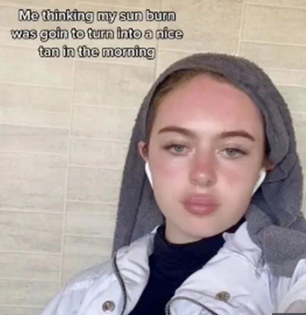 Emma doznała zatrucia słonecznego