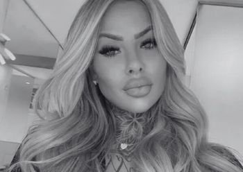 Zmarła influencerka Bianca Dias. Dostała zatoru po zabiegu