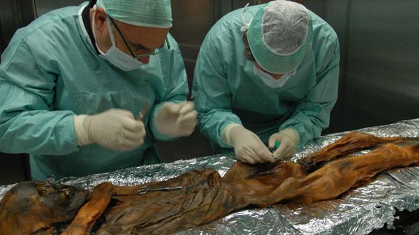 Co znaleziono w mumii sprzed 5 tys. lat? 1