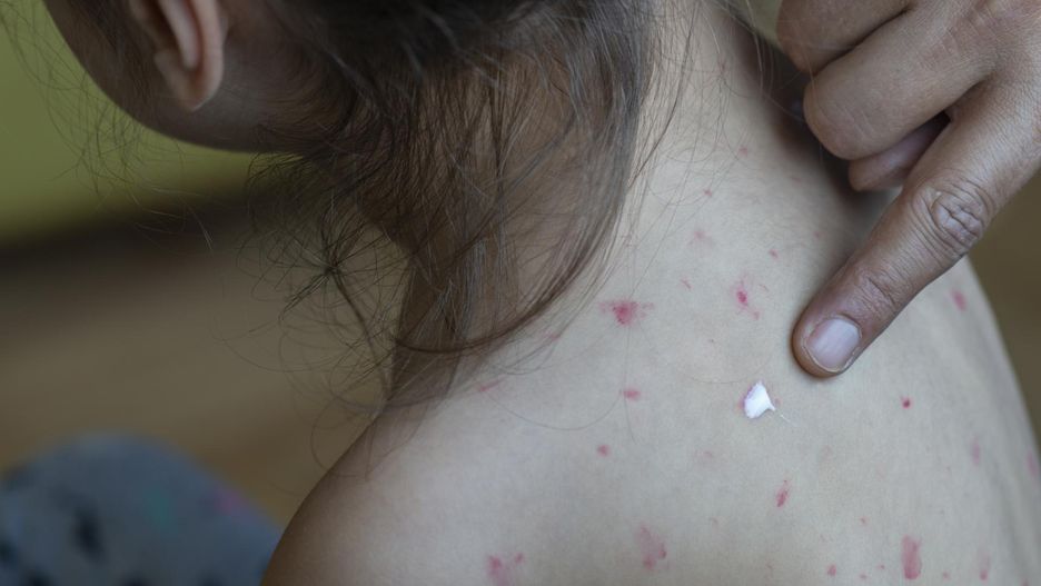 Lekarka szczerze o wzrośnie zachorowań. "Nie rozumiem rodziców"