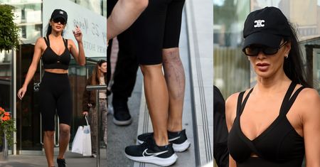 Poparzona Nicole Scherzinger szwenda się po mieście. Odsłoniła blizny (ZDJĘCIA)