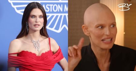 Bianca Balti choruje na raka. Topmodelka pokazuje się bez włosów i mówi o chorobie: "Życie już mnie nie przeraża"