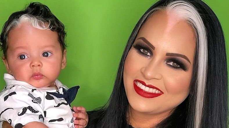 Kobieta i jej synek mają białe pasma włosów nad czołem