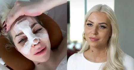 Julia von Stein ekscytuje się NOWYM NOSEM. Internautka gorzko o efekcie: "Nie widać różnicy". Celebrytka REAGUJE! (FOTO)
