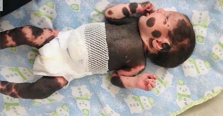 Lekarze proponowali, by porzucili synka. Tak dzisiaj wygląda dziecko panda