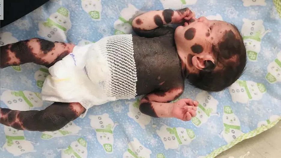 "Chłopiec-panda" skończył trzy lata