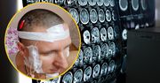 Przewiercił sobie głowę wiertarką. 40-latek z Rosji cudem przeżył