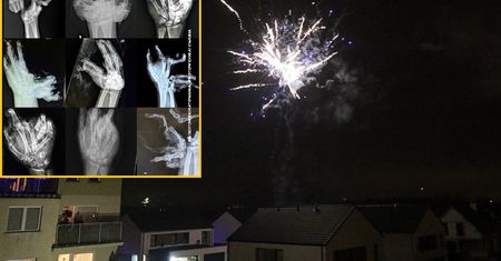 "Puzelki" z ludzkich ciał. Ratownicy pokazali zdjęcia z zeszłego sylwestra