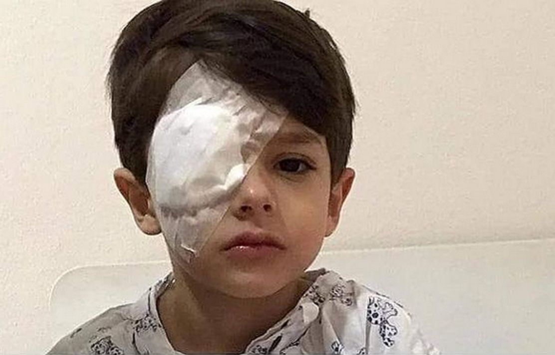 Żel do dezynfekcji spalił mu rogówkę. Chłopiec trafił do szpitala