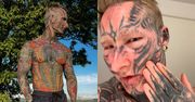 Wydał FORTUNĘ, aby pokryć ciało tatuażami, dziś relacjonuje żmudny proces ich USUWANIA. Tak wyglądał przed metamorfozą