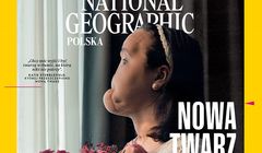 „National Geographic Polska” publikuje reportaż o pacjentce z całkowitym przeszczepem twarzy