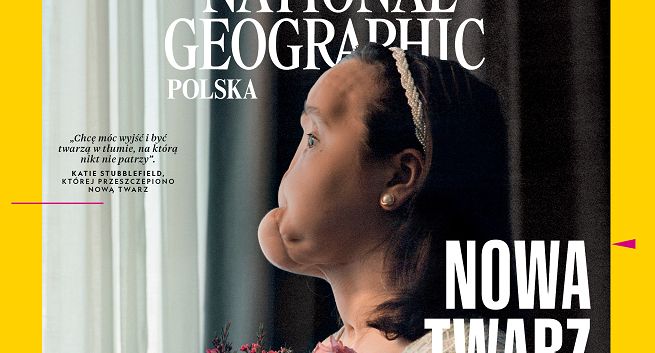 „National Geographic Polska” publikuje reportaż o pacjentce z całkowitym przeszczepem twarzy