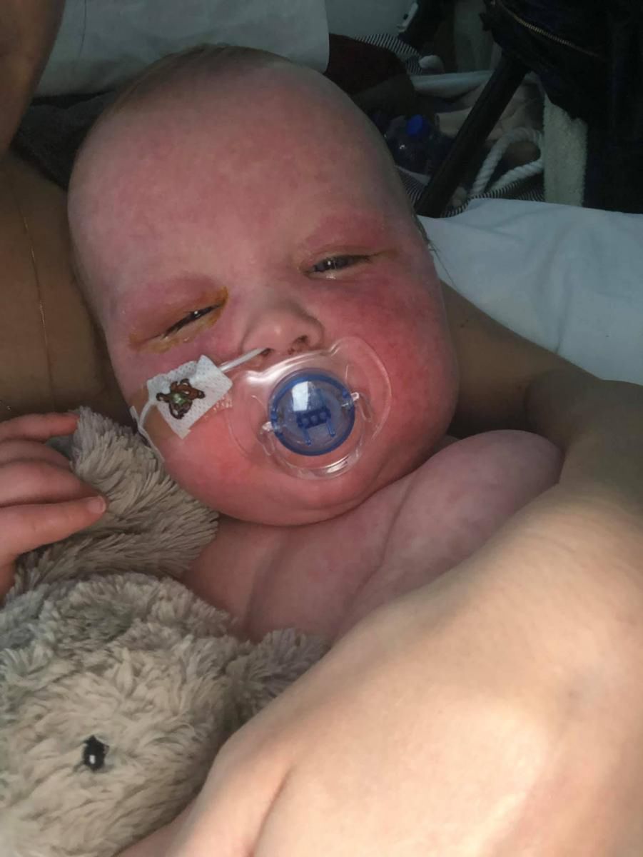 Dziewczynka miała problem z oddychaniem