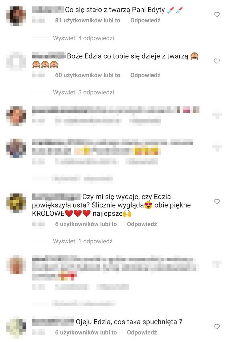 Internauci martwią się o zmiany w wyglądzie Edzi z "Królowych życia"