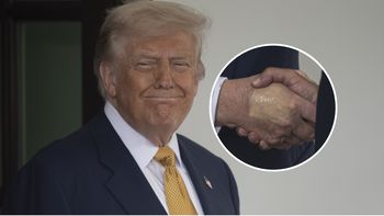 Zdjęcie dłoni Donalda Trumpa zaniepokoiło internautów. Biały Dom zareagował
