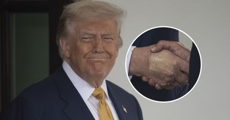 Zdjęcie dłoni Donalda Trumpa zaniepokoiło internautów. Biały Dom zareagował