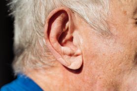 Przyjrzyj się uważnie swoim uszom. Ten objaw wskazuje na chore serce