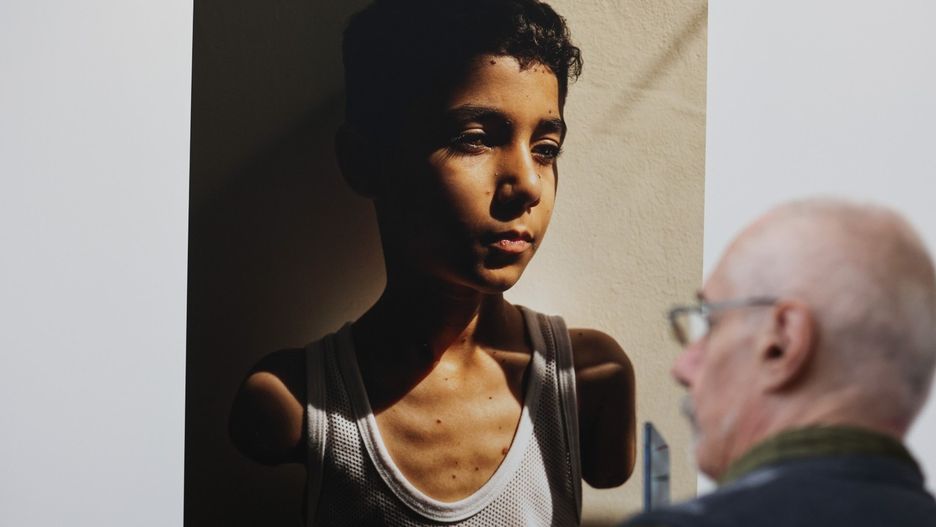 Zwycięska fotografie 68. edycji World Press Photo przedstawia 9-letniego Mahmouda Ajjoura rannego podczas izraelskiego ataku na Strefę Gazy