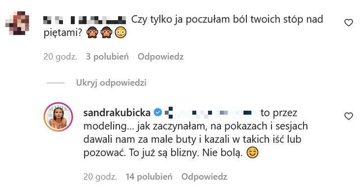 Fani o bliznach Sandry Kubickiej