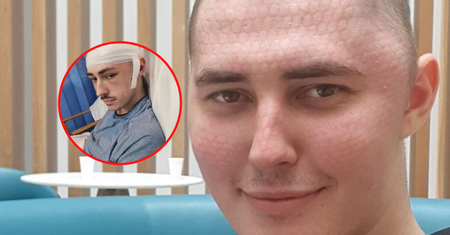 Lekarz zalecił leki przeciwbólowe. 23-latek ma guza mózgu wielkości grejpfruta
