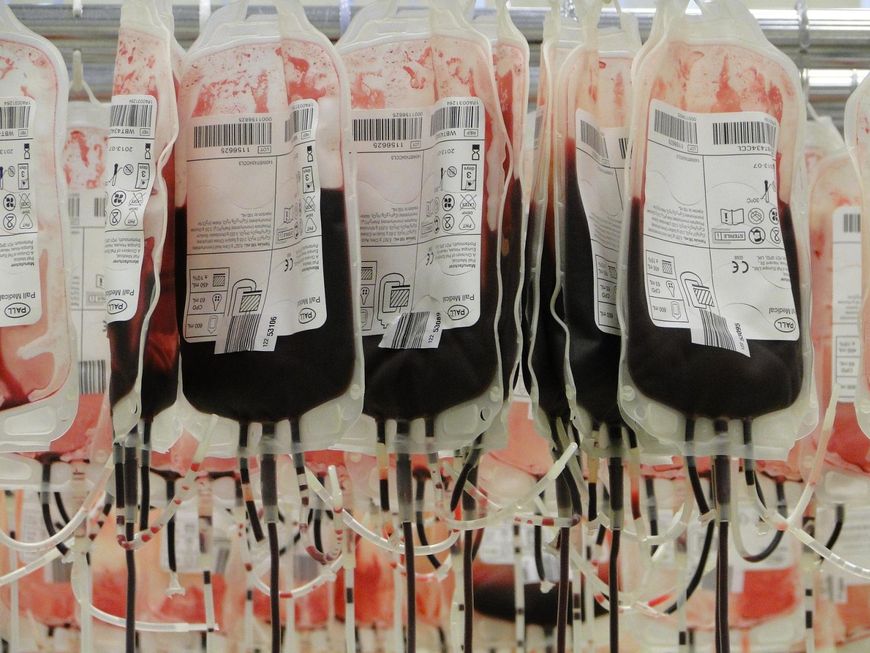 Grupa krwi może się zmienić u osób, które przeszły przeszczep szpiku kostnego