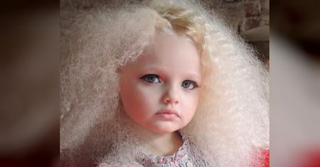 2-latkę okrzyknięto żywą lalką Barbie. Ale dawne ''atuty'' już zniknęły