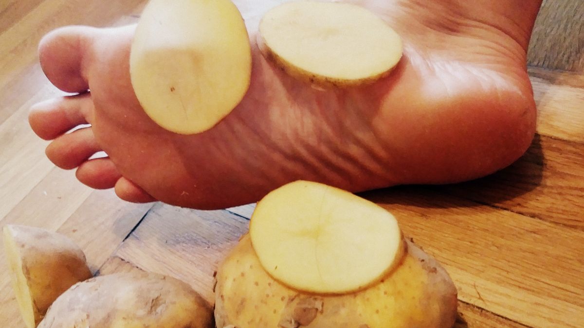 Ziemniaki mogą pomóc na potliwość stóp 