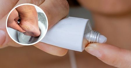 Apteczny hit na suche pięty. Ta maść zadziała jak plaster