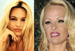 "Słoneczny patrol": Nowa twarz Pameli Anderson