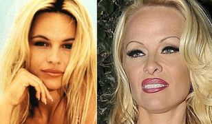 "Słoneczny patrol": Nowa twarz Pameli Anderson