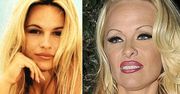 "Słoneczny patrol": Nowa twarz Pameli Anderson