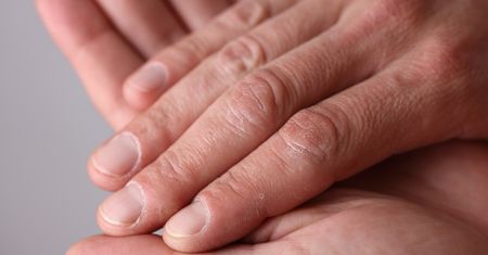 Sygnał, że masz problem z wątrobą. Pojawia się w 80 proc. przypadków