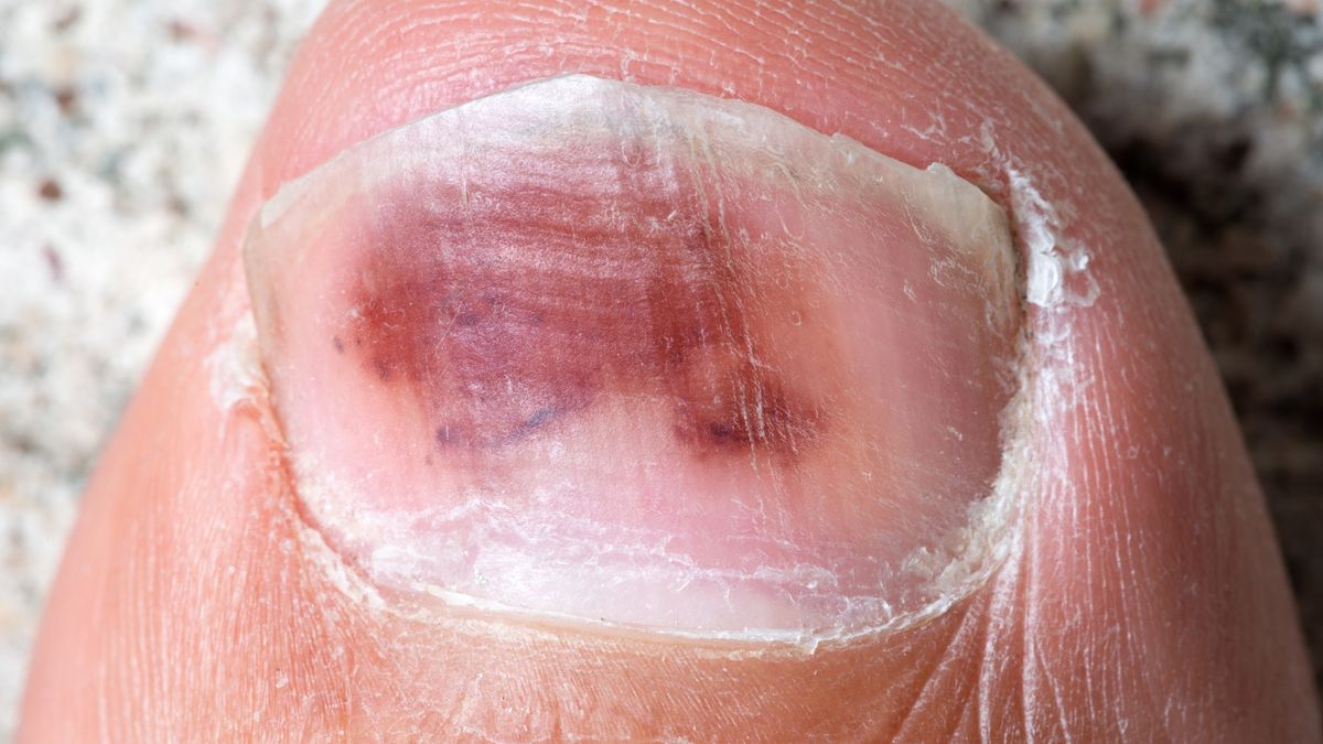 Wygląd stóp i paznokci może wskazywać na poważne choroby