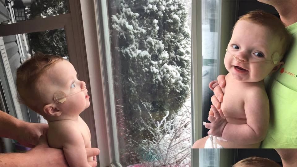 Dziewczynka z wrodzoną wadą serca po raz pierwszy w życiu widzi śnieg