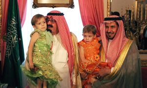 Pomógł im książę Arabii. Jak bliźniaczki syjamskie wyglądają teraz?