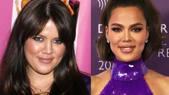 "50 TWARZY" Khloe Kardashian. Tak zmieniała się przez lata (ZDJĘCIA)