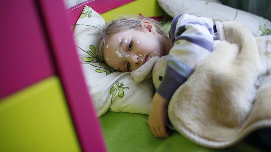 03.03.2010 POZNAN DZIEWCZYNKA CHORA NA OSPE OSPA WIETRZNA FOT. GRZEGORZ DEMBINSKI / POLSKAPRESSE GLOS WIELKOPOLSKI