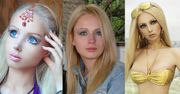 "Ludzka Barbie" przeszła 13 operacji plastycznych!