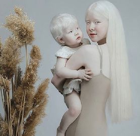 Siostry albinoski podbijają media społecznościowe. Internauci nie wierzą, że są prawdziwe