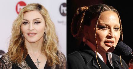 Lekarz wylicza, jakim zabiegom poddała się Madonna. Lista jest długa... "Zmiana kształtu twarzy jest DRASTYCZNA" (ZDJĘCIA)