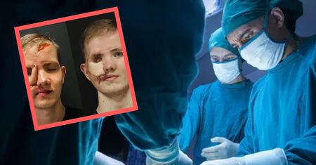 Przeszczepili mu skórę z uda. Tak odbudowali twarz 16-latka