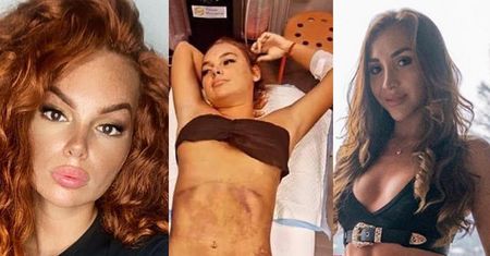 Nathalia i Justyna z "Hotelu Paradise" poddały się "LEKKIEJ KOREKCIE CIAŁA" (FOTO)